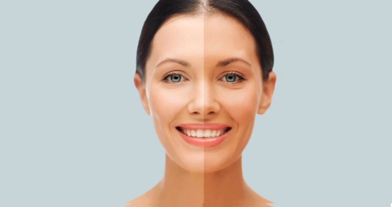 Kosmetik (1) - Skin brightening