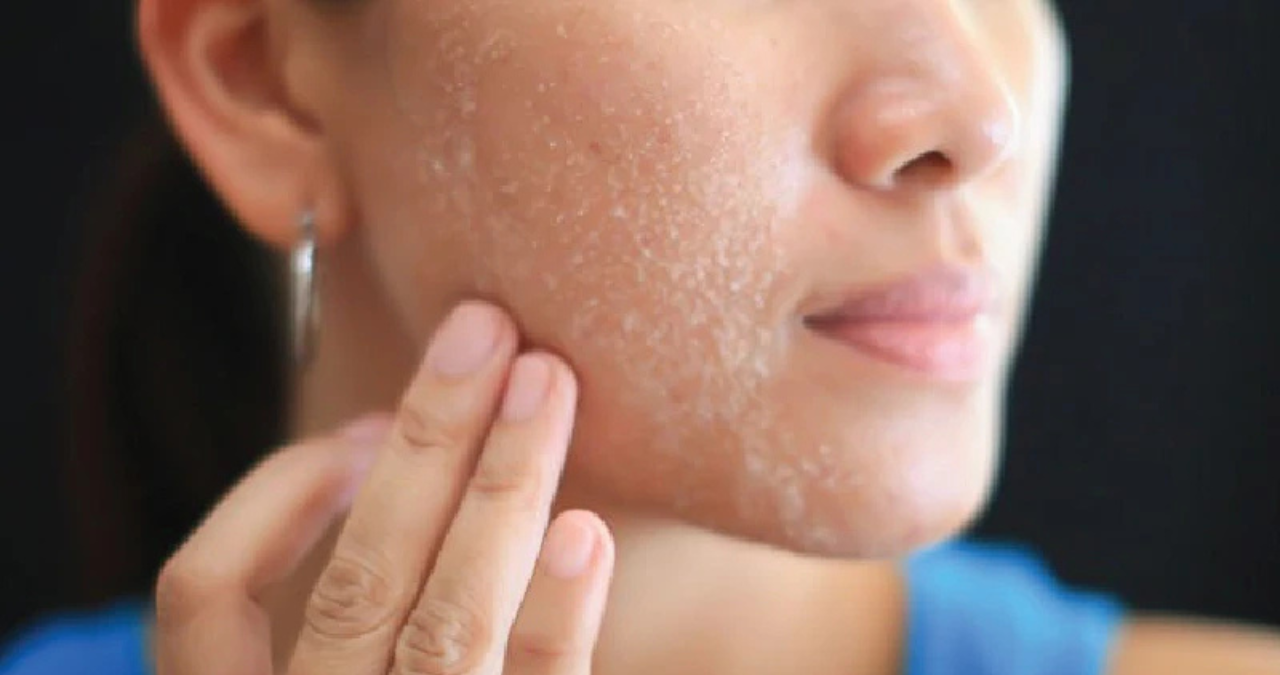 Kosmetik (7) Dry skin